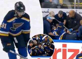 Dylan Holloway Hospitalized After Puck Hit – Blues News & Updates news-06112024-162357