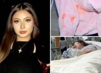 Chicago Teen Left Blind in One Eye After City-Wide Terrorizing Incident news-08112024-102120