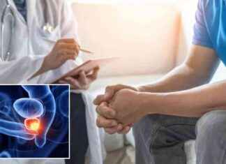 Prostate Cancer Cases Spike in US State: Doctors Share Likely Reasons prostate-cancer-cases-spike-in-us-state-doctors-share-likely-reasons